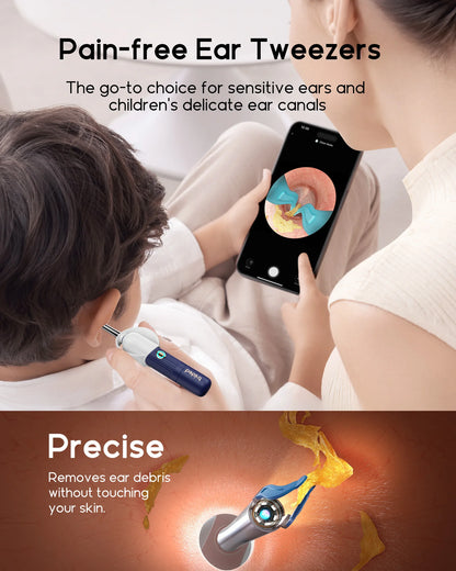 HD Visual Ear Cleaner with Camera & Tweezers