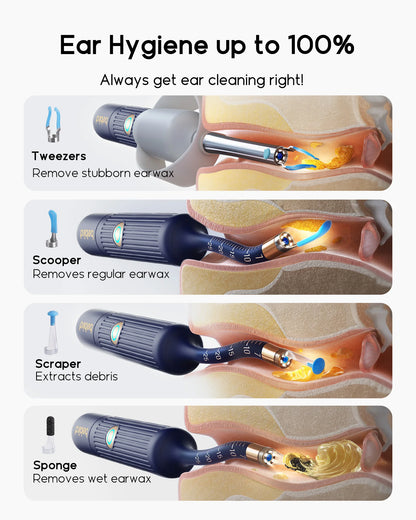 HD Visual Ear Cleaner with Camera & Tweezers
